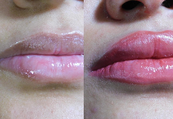 work lips micro l