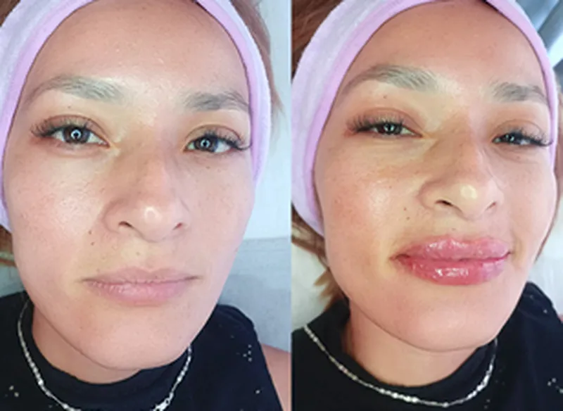 banner web medicina estetica 2 s resultado