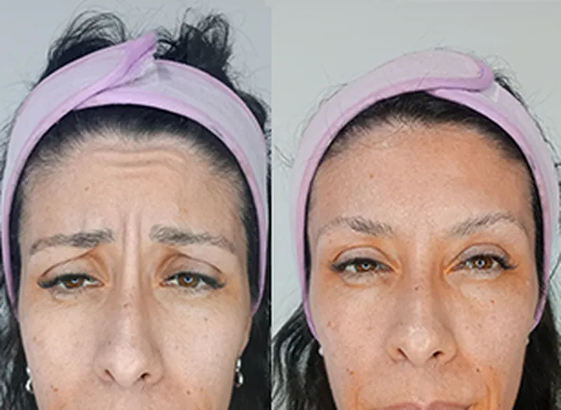 banner web medicina estetica s resultado